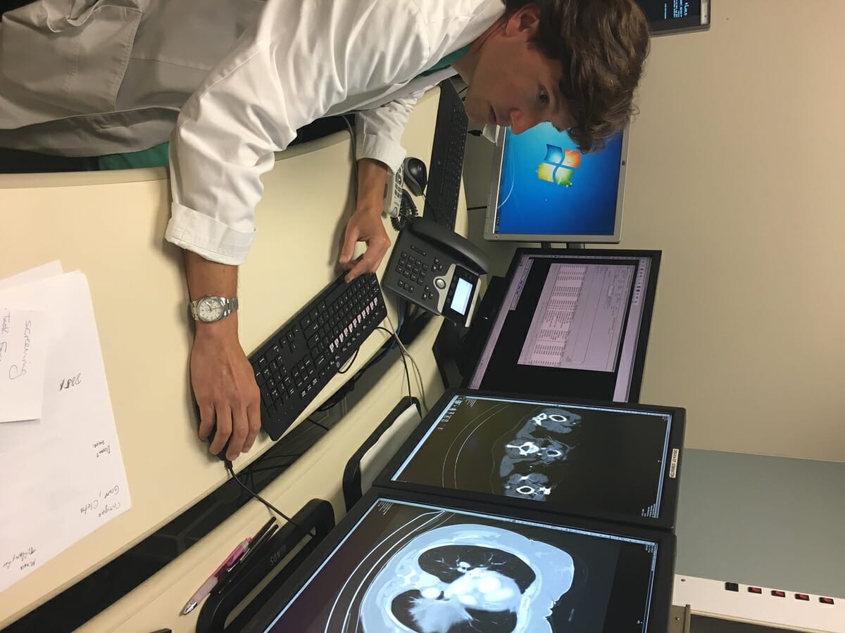 Beaufort Memorial radiologist Dr. Eric Billig reviews low dose computed tomography (LDCT) scans. LDCT scans of the chest provide more detailed images than X-rays and are better at finding abnormal areas in the lungs. Photo provided.
